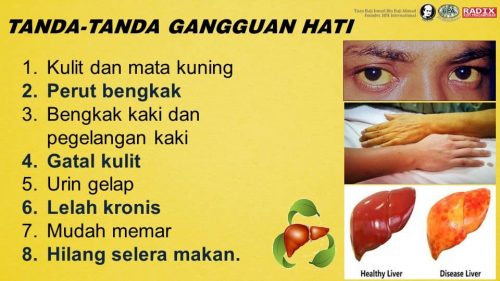 Detoks 3