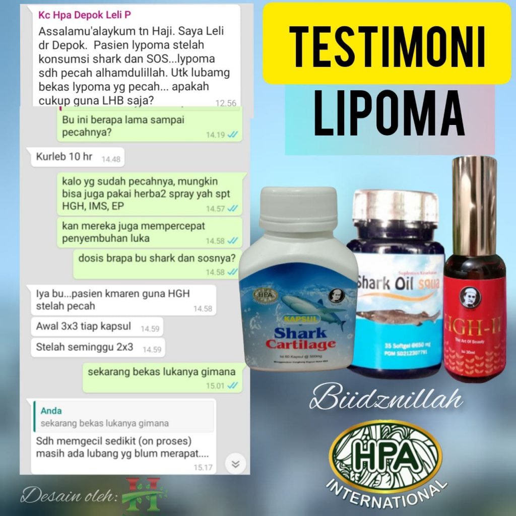 Testimoni Lipoma