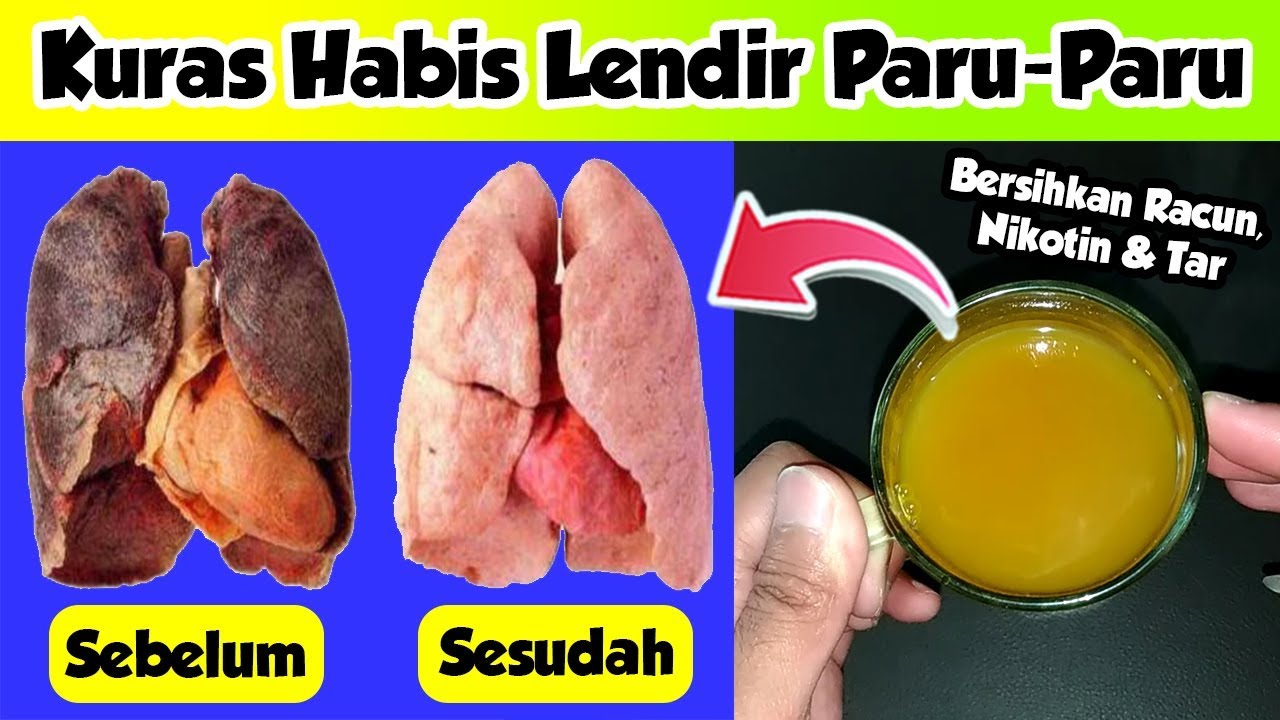 Resep HPA untuk mengeluarkan lendir di paru-paru