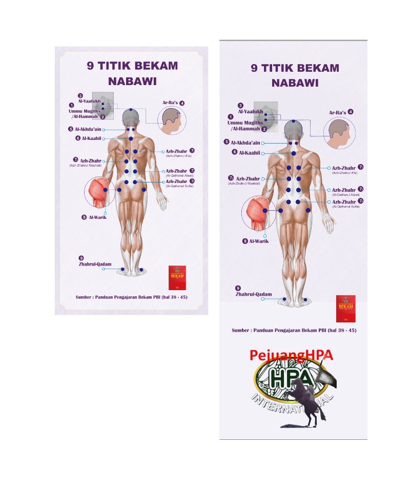 Poster 9 Titik Bekam Sunnah